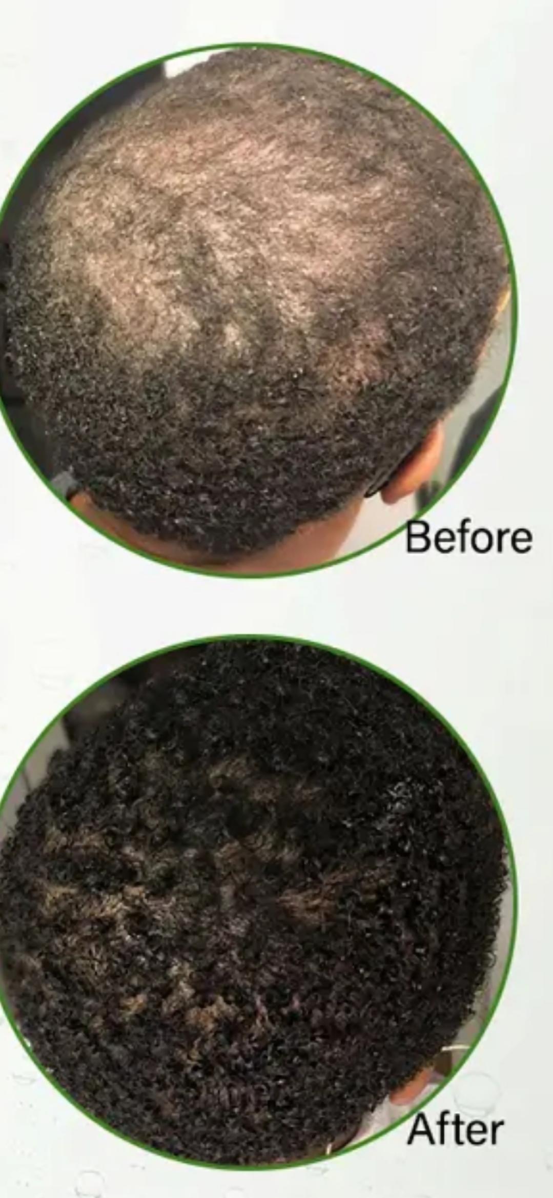 Nutrient Hair Growth Oil ( Suitable For all ages)